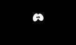Bar Mitzvah Blackout!